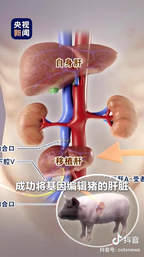 基因编辑技术突破！我国成功实现猪肝替代人肝，医学迎来新纪元